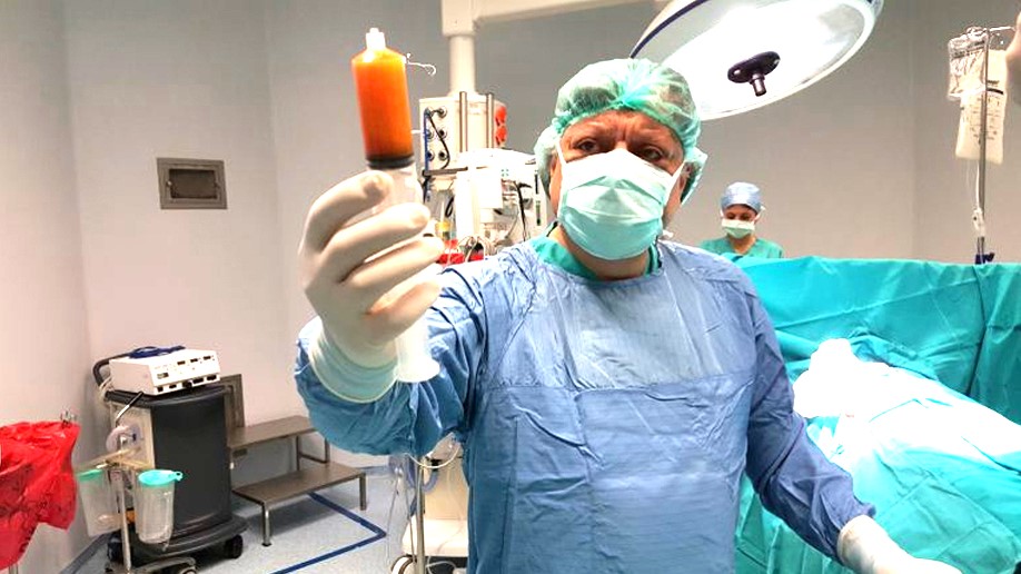Karın bölgesinden özel cihazlar kullanılarak alınmış yağ dokusunun işlenmemiş hali görülmekte.