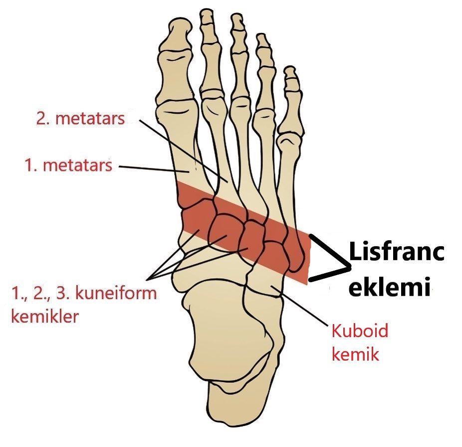 Ayakta Lisfranc ekleminin şematik çizimi